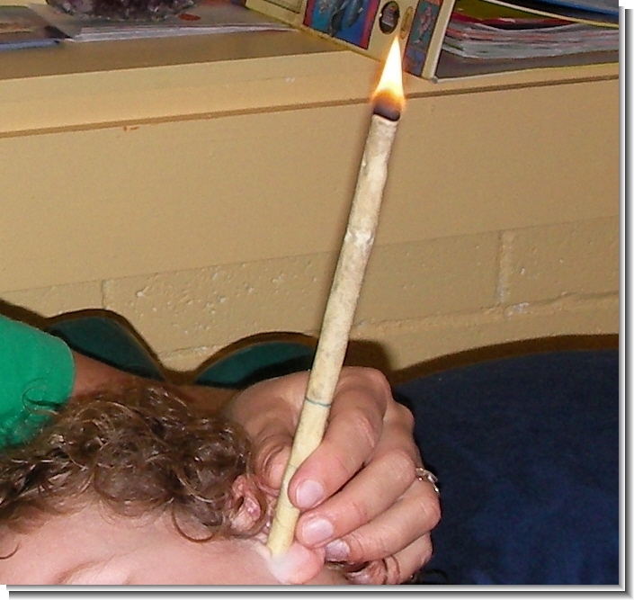 ear candles